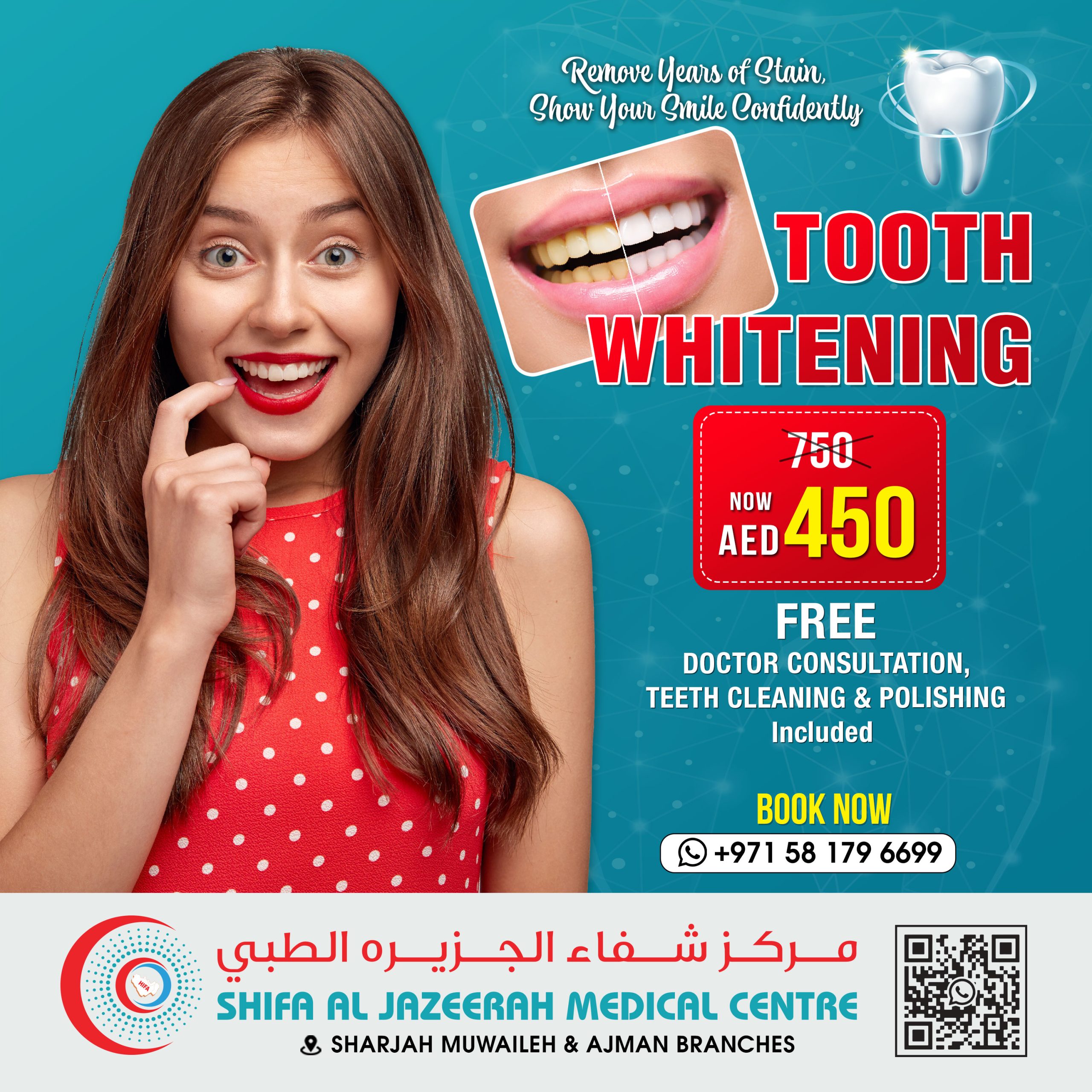 TOOTH WHITENING